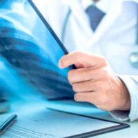 lo pneumologo risponde