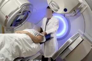 Effetti collaterali radioterapia